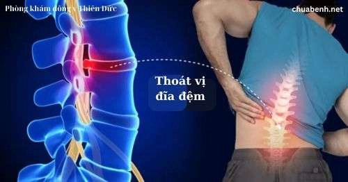 minh họa cột sống trung lập khi nằm đệm Ru9